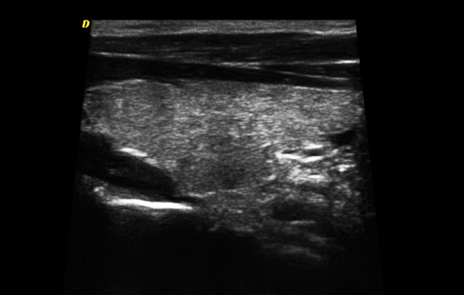 Trapezoidal Imaging