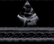 Anatomic M-mode Imaging