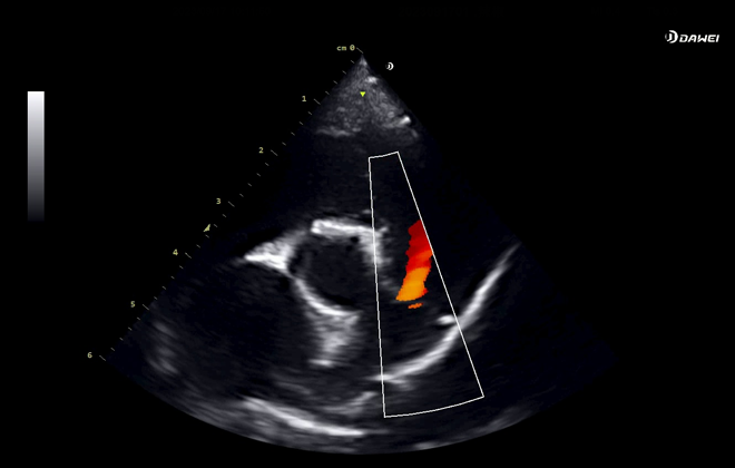 ST-U Single Crystal Probe