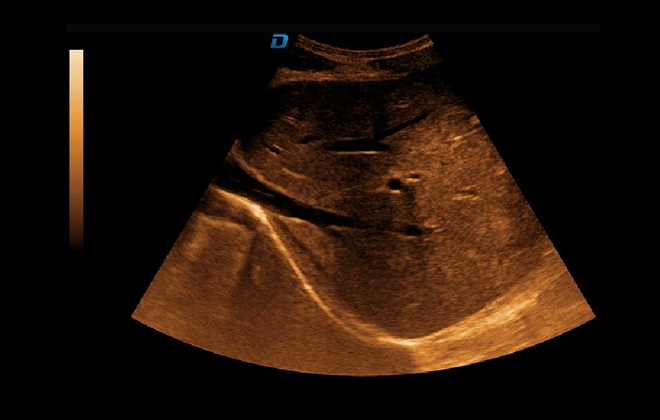 Contrast Tuned Imaging Technology 