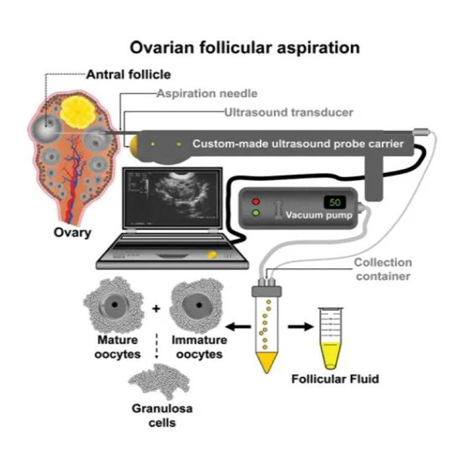 Operating principle